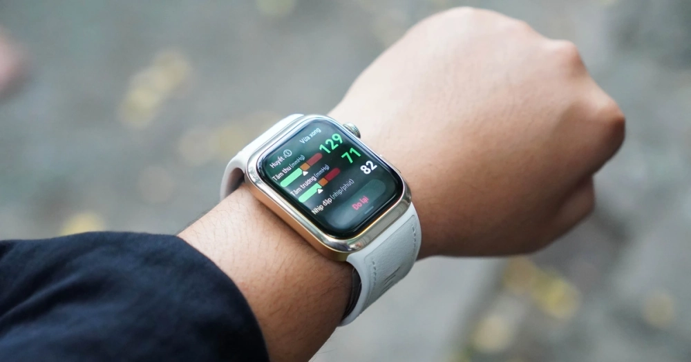 tính năng Smartwatch cần biết